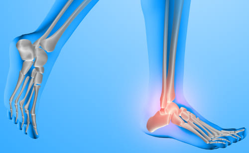 AZ Ortho, orthopédiste, orthésiste, podologiste, semelles orthopédique, orthèses plantaires